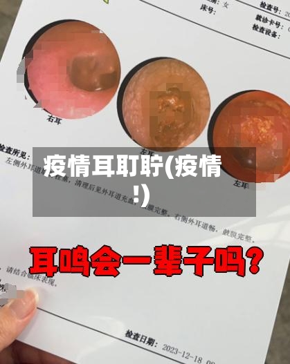 疫情耳耵聍(疫情!)-第2张图片