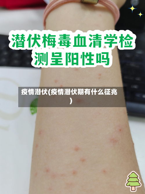 疫情潜伏(疫情潜伏期有什么征兆)-第3张图片