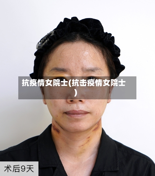 抗疫情女院士(抗击疫情女院士)-第2张图片